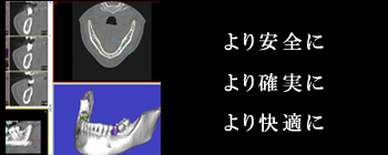 �C���v�����g